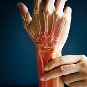 Baja Hand -  Wrist treatment