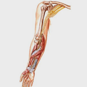 Baja Hand - Brachial Plexus treatment
